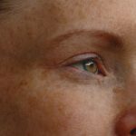 Climate anxiety, or eco-anxiety, refers to worry or distress related to climate change.