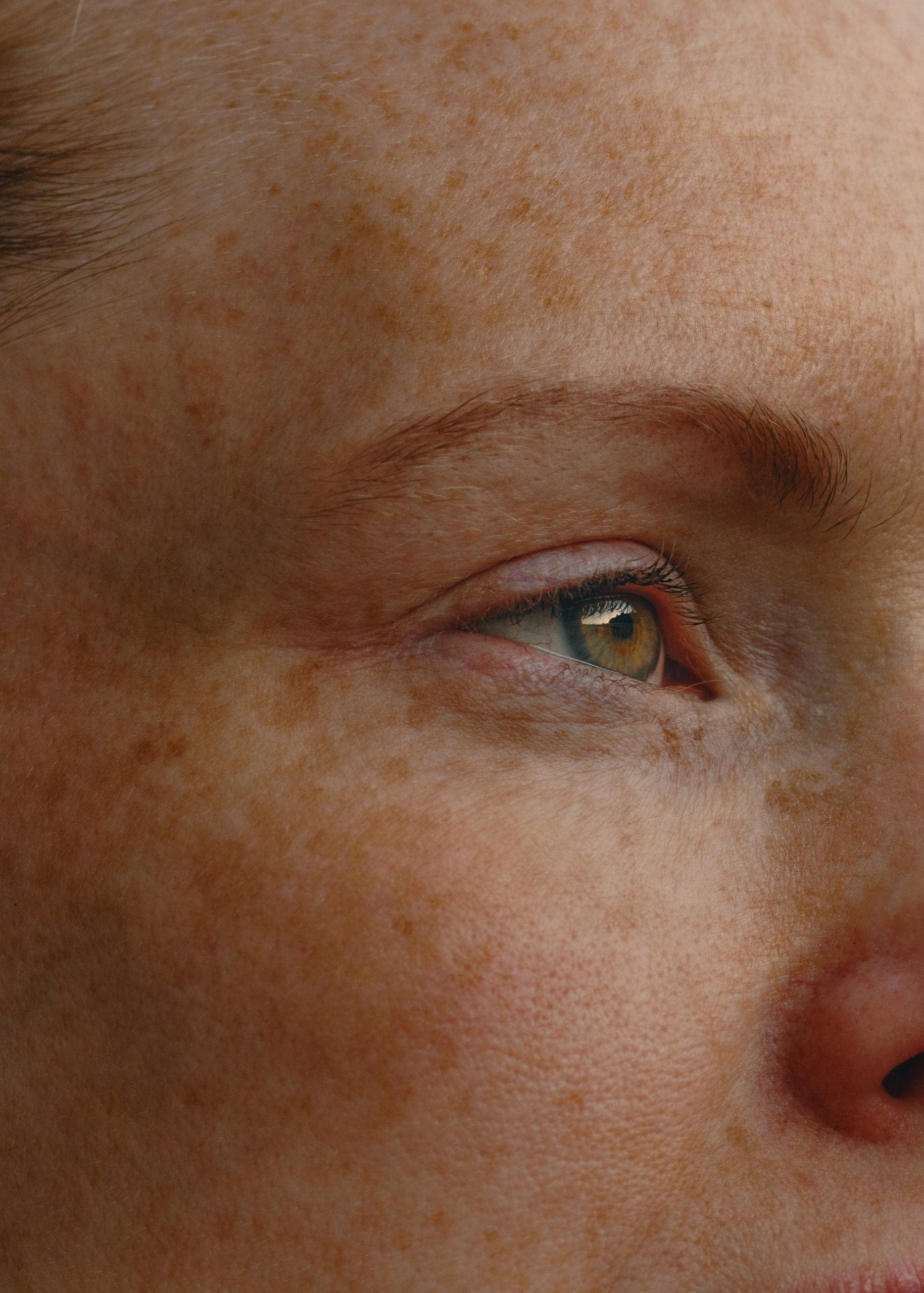 Climate anxiety, or eco-anxiety, refers to worry or distress related to climate change.